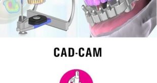 Applications of computer-aided design of the 3D-CAD-CAM system for technology ... ...